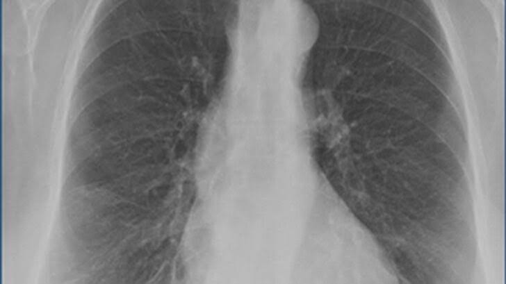 X-ray Cihazından Geçerken Fark Edildi!