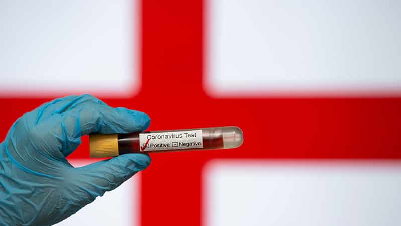 İngiltere’de Can Kaybı 37 Bini Aştı!