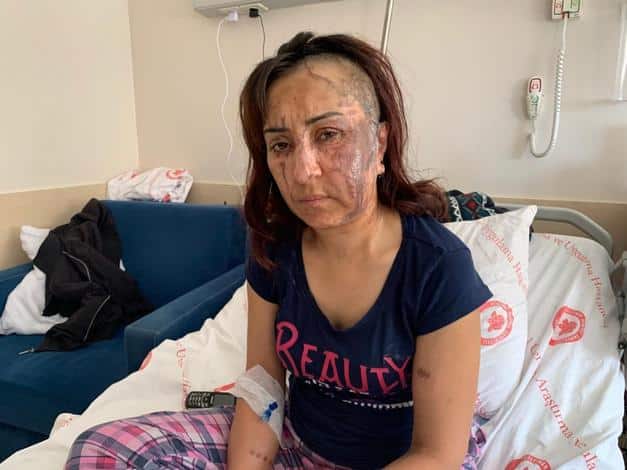 Kezzaplı Saldırgana İlişkin Açıklama