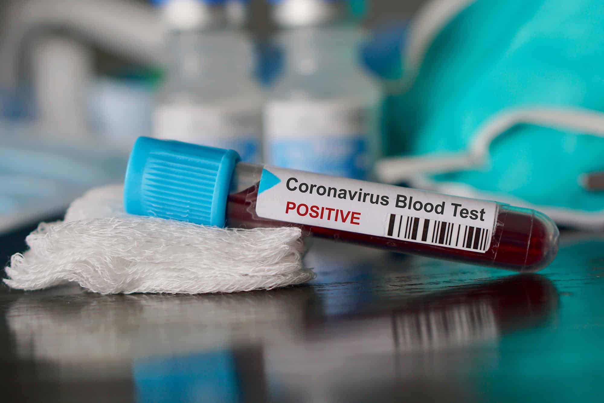 Acı Olay: 9 Yaşındaki Çocuk Koronavirüsten Hayatını Kaybetti