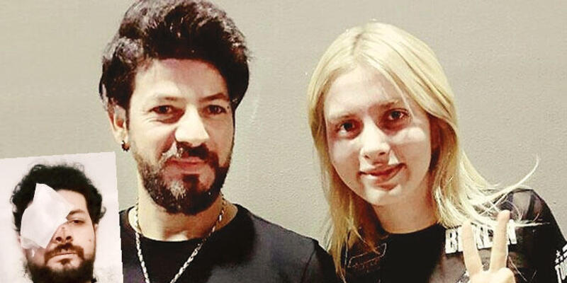 Genç Şarkıcı Maganda Kurşunu Nedeniyle Gözünü Kaybetti!