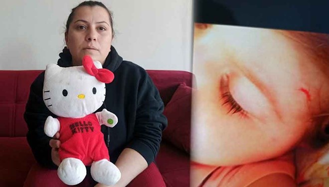 Kızına Uygulanan Şiddeti Oyuncakla Ortaya Çıkardı!