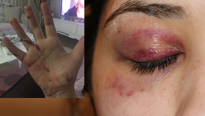 Önce Darbetti Sonra “Pide Yaptırayım Mı?” Diye Mesaj Attı