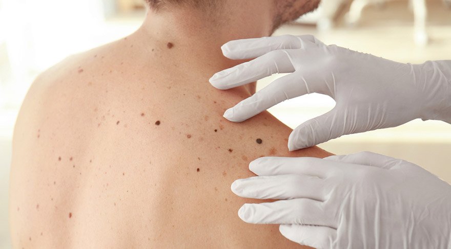 Vücudunuzda Asla Görmek İstemeyeceğiniz 10 Şey