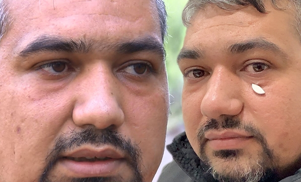 Gözünün Altındaki Metal Parçayı Mıknatıs Sayesinde Fark Etti!