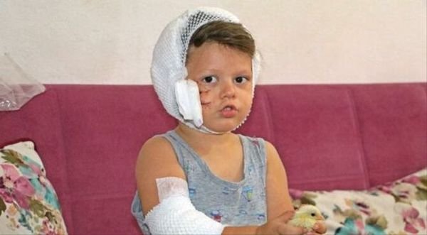 Köpeğin Saldırdığı Küçük Çocuk Ölümden Döndü