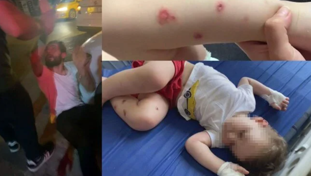 1,5 Yaşındaki Bebeğine İşkence Yaptığı Ortaya Çıktı, Meydan Dayağı Yedi!