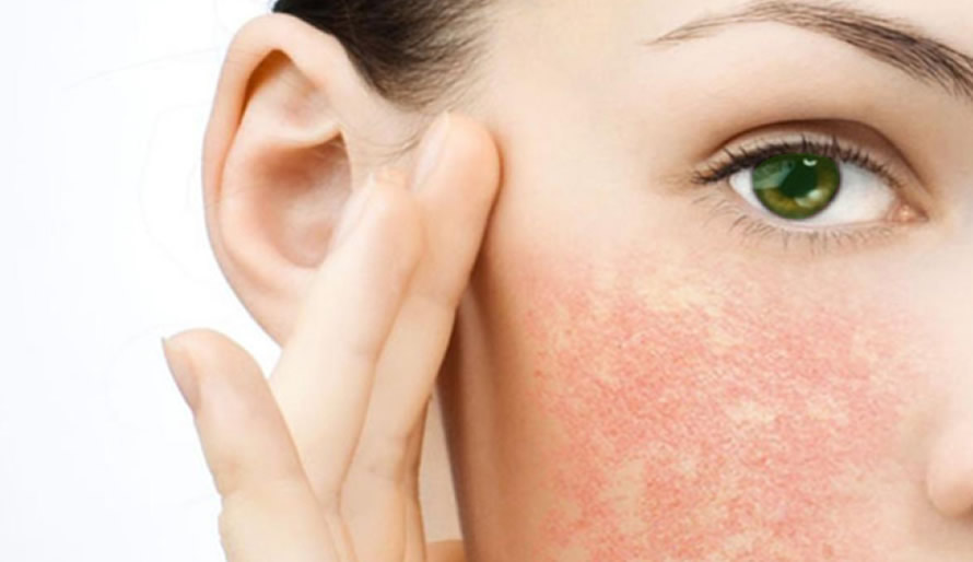 Cildinizin Kurumasına Yol Açacak Alışkanlıklar