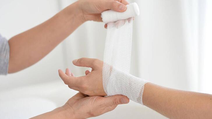 Yanık Tedavisi Nasıl Yapılır? Yanığa Ne İyi Gelir?