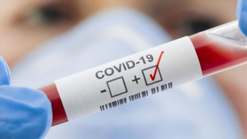 19 Kasım Covid-19 Tablosu Açıklandı