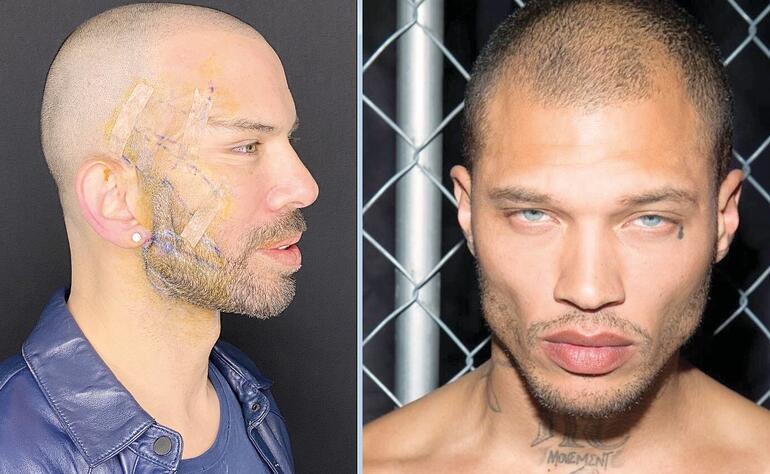 Fransız Askısı Yaptıran Berksan’ın Son Hali Şaşırttı