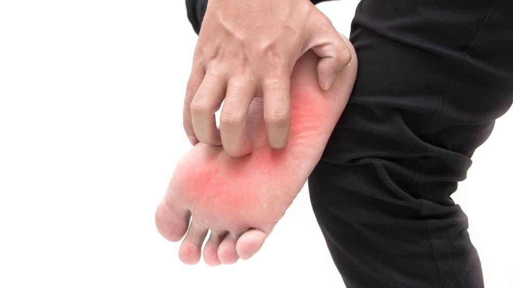 Ayakaltı yanmasına ne iyi gelir? Ayak tabanı yanması neden olur?