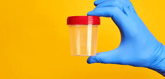 Lökosit Nedir, İdrarda Lökosit Nedir?