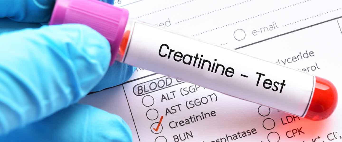 Keratinin Nedir? Keratinin Düşüklüğü Nelere Sebep Olur?