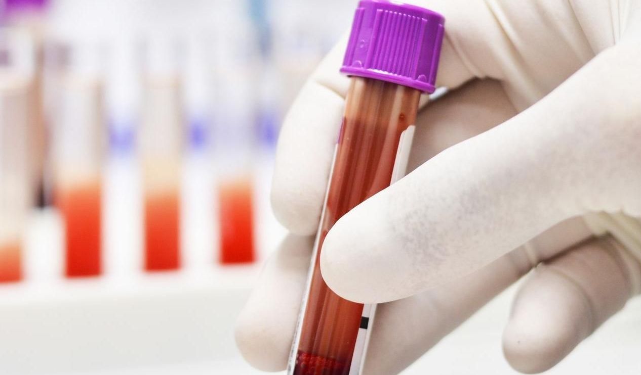 Sedimantasyon Nedir? Sedimantasyon yüksekliği nedir?