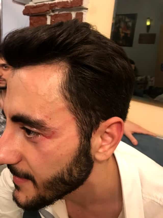 Reynmen Muhabirlere Saldırdı Karakolluk Oldu!