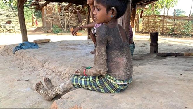 Cildi Gün Geçtikçe Taş Oluyor!