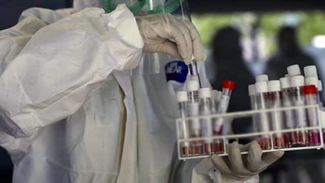 Türkiye'den Koronavirüs Aşısı Kapsamında Bir İlerleme!