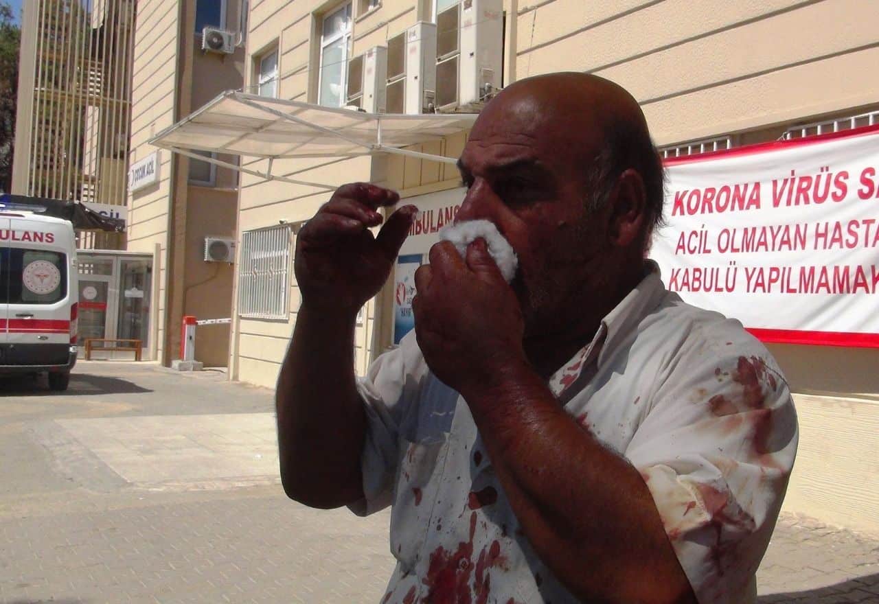 Bayram Bilançosu: 5 bin 282 Yaralı Acemi Kasap