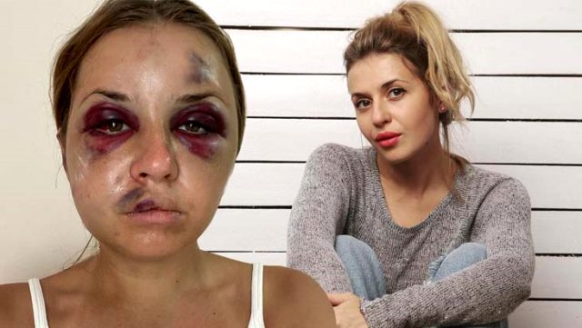 Ünlü Sunucu Tren Yolculuğunda Bir Sapık Tarafından Şiddet Gördü!