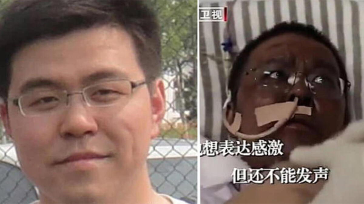 Koronavirüs Nedeniyle Rengi Değişen Doktor Eski Haline Döndü