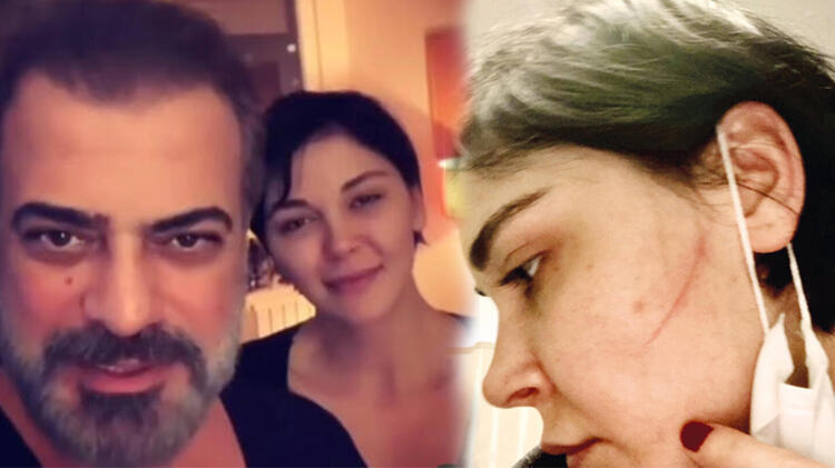 Sevcan Yaşar: Sermiyan Beni Darp Edip Videolarımı Çekti!