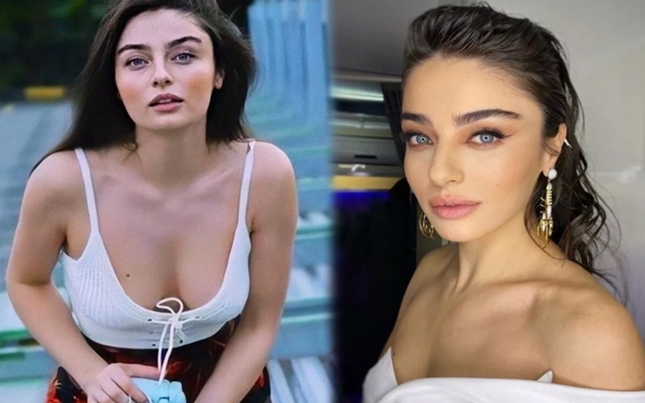 Güzel Oyuncunun Estetiksiz Hali Görenleri Şaşırttı