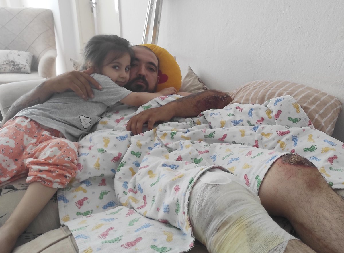 Kamyon Sürücüsü Direksiyonu Üzerine Kırmıştı: Yaralı Genç Konuştu