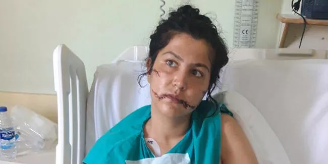 104 Yerinden Bıçaklanan Kadın: Pencereye Bile Çıkamıyorum