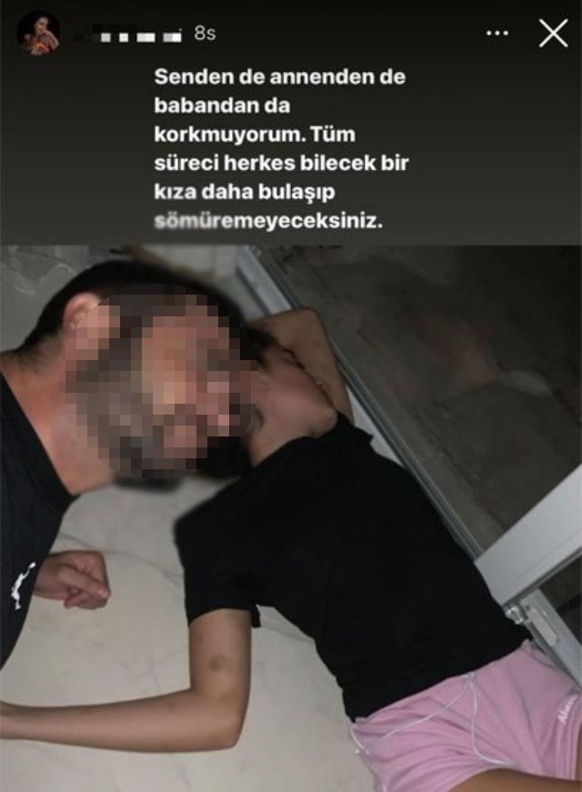 Eşi Tarafından Şiddet Gören Fenomen İrem Ay Yardım İstedi