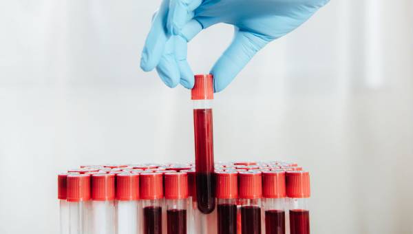 CRP Nedir, CRP Kaç Olursa Tehlikeli?