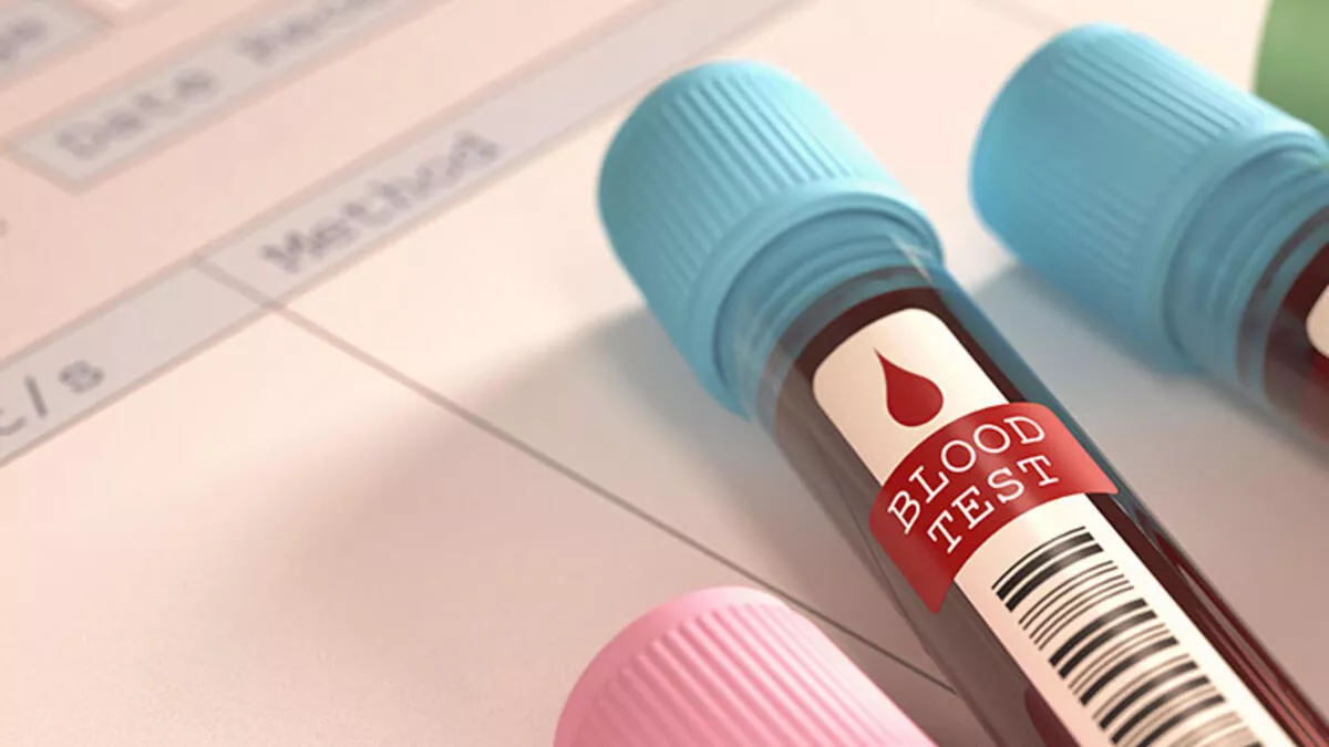 RDW Nedir? RDW Yüksekliği ve Düşüklüğü Nedir?