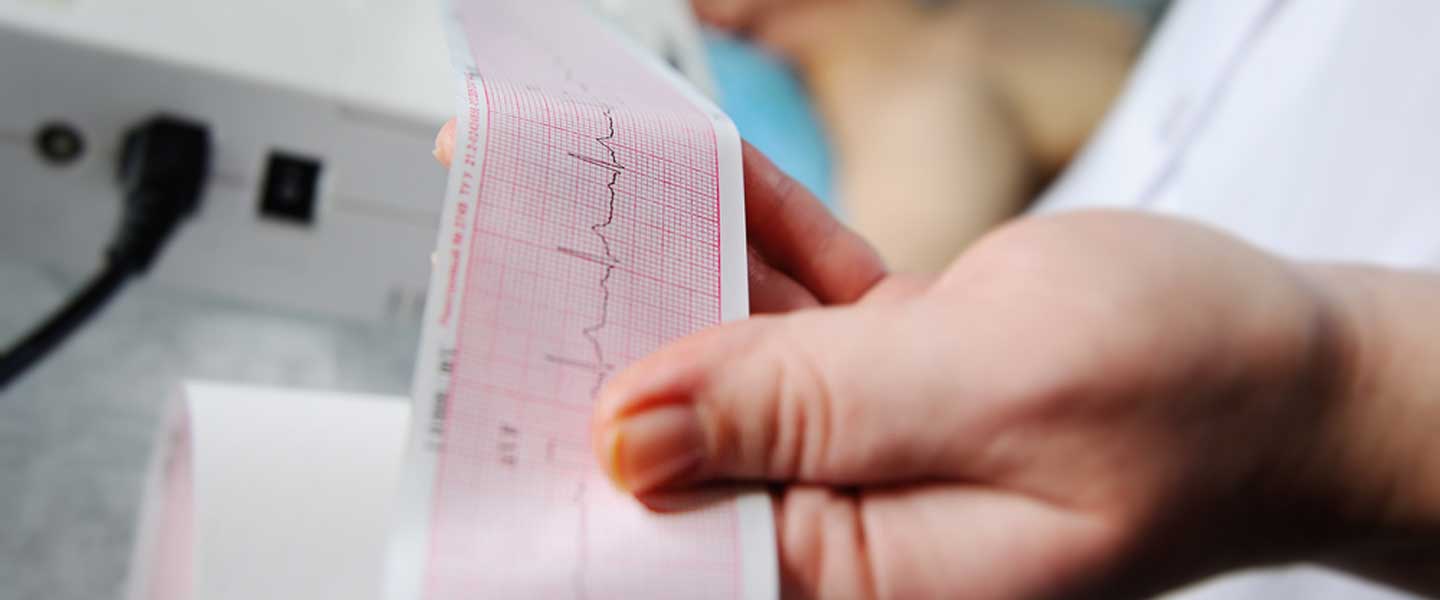 Taşikardi Nedir? Taşikardi Belirtileri Nelerdir?