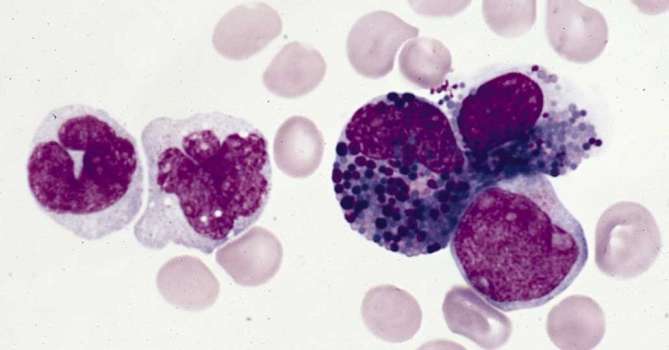 Eozinofil Nedir? Eozinofil Yüksekliği ve Düşüklüğü Ne Anlama Gelir?