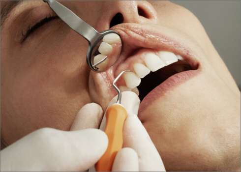 Periodontoloji Nedir? Periodontoloji Neye Bakar?