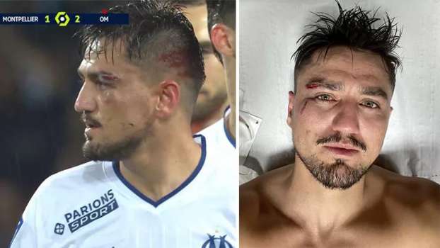 Yüzüne Darbe Alan Cengiz Ünder: "Seni Öldürmeyen Şey Güçlendirir"