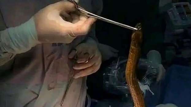 Kabızlığını Gidermek İçin Yılan Balığı Kullandı!