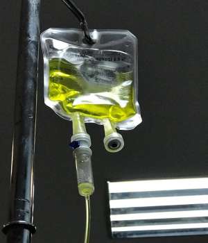 Sarı Serum Nedir, Sarı Serum Ne İşe Yarar?