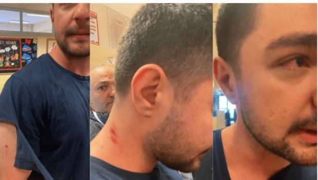 Ak Partililer TİP Üyesine Saldırıda Bulundu