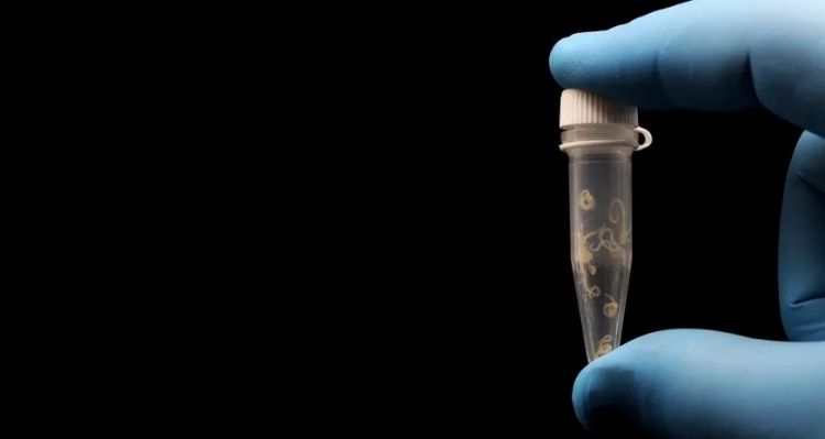 Vücudunu İstila Eden Parazitleri Röntgende Gördü! Şoke Eden Görüntüler