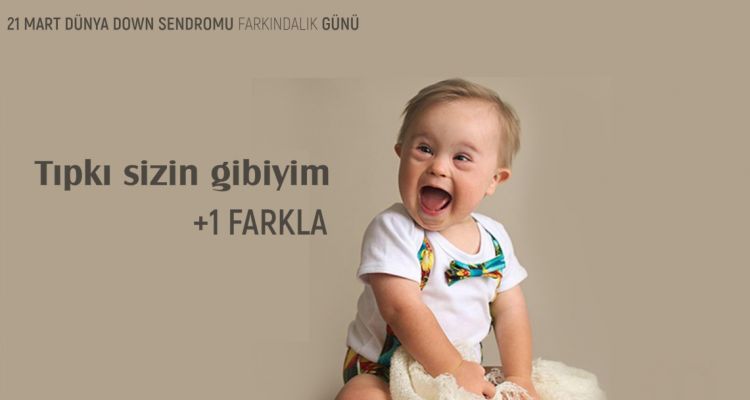 Erken Destekle Down Sendromlu Bireyler Topluma Kazandırılıyor