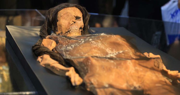 Kanser Tedavisinde Tarihi Mantar Umudu: Aspergillus Flavus