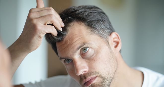 Saç Dökülmesine Karşı Ne İyi Gelir? Doğal Çözümler Rehberi