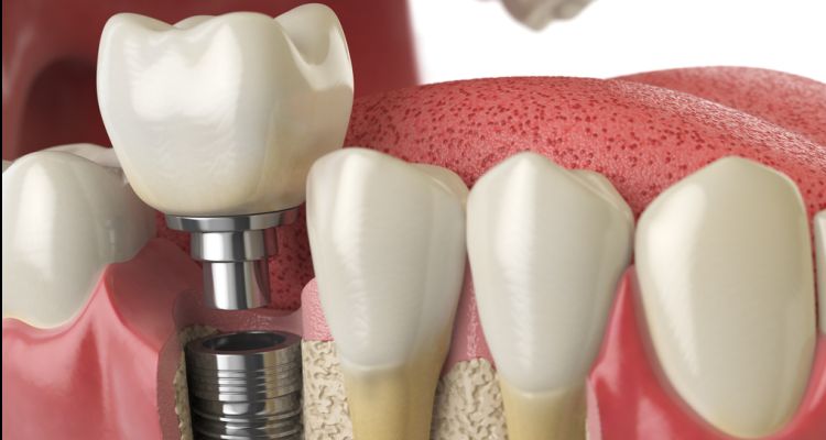 Kayıp Dişler Yeniden Çıkabilir Mi? Ses Getiren Çalışma!