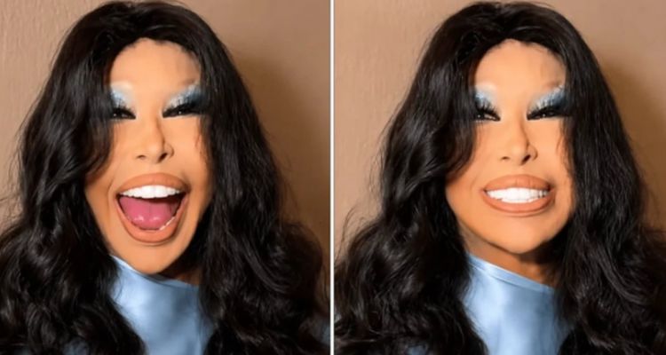 Bülent Ersoy'un Son Hali Gündem Oldu! Lolita Lift Sonrası İlk Kareler